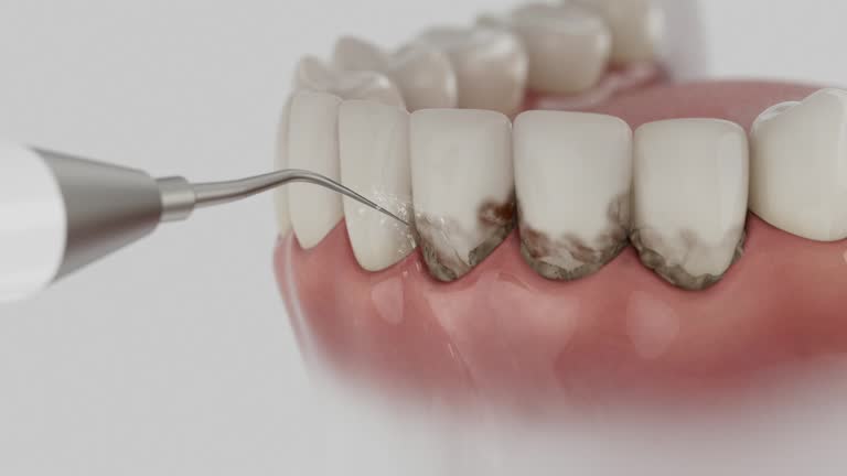 Trusted Wisdom Tooth Removal service in Lindsborg, KS - Dentist Open Now